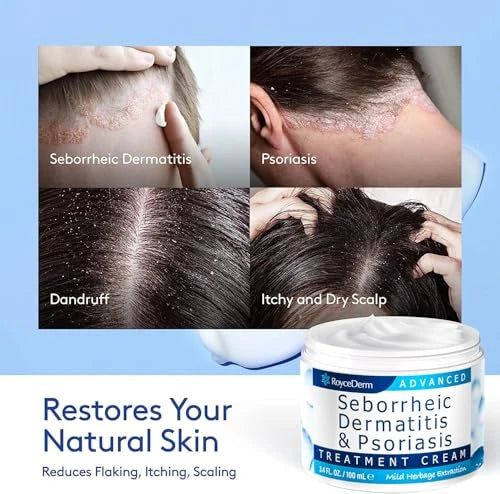 CREMA PARA CUERO CABELLUDO CON DERMATITIS SEBORREICA ROYCEDERM