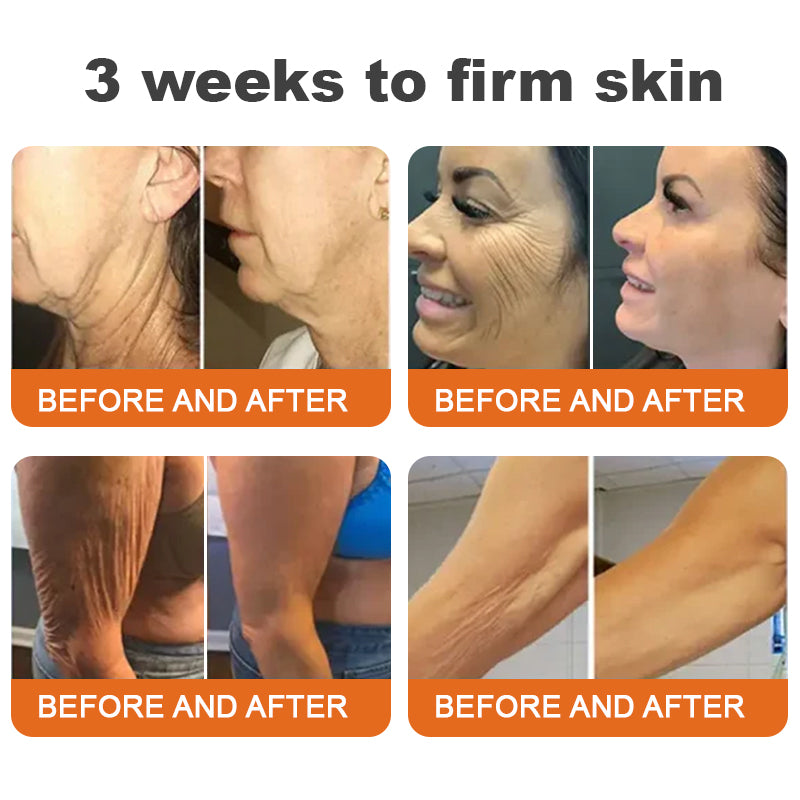 Barra de Suero Reafirmante con Veneno de Abeja y Botox
