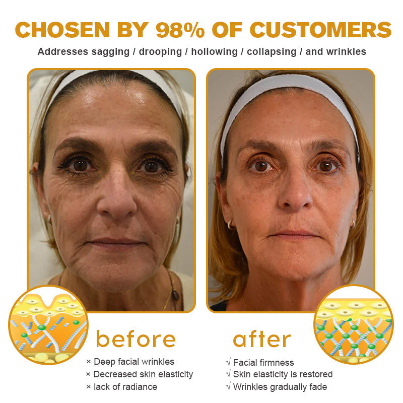Crema para eliminar arrugas con veneno de abeja y botox